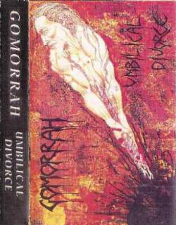 Gomorrah (UK-1) : Umbilical Divorce Gomorrah (UK-1) : Umbilical Divorce